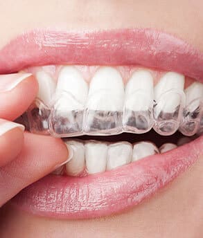 A person wearing Invisalign in Pearland, TX