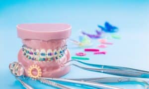 Exploring The Origins Of Orthodontics: A Concise History